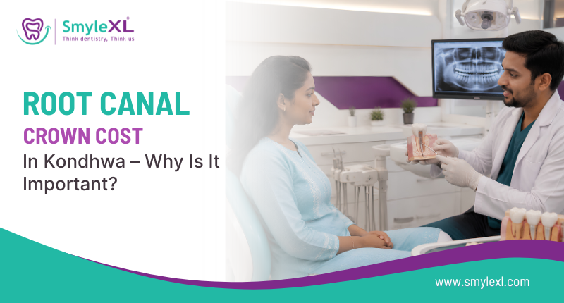 Root Canal Crown Cost in Kondhwa – Why Is It Important?