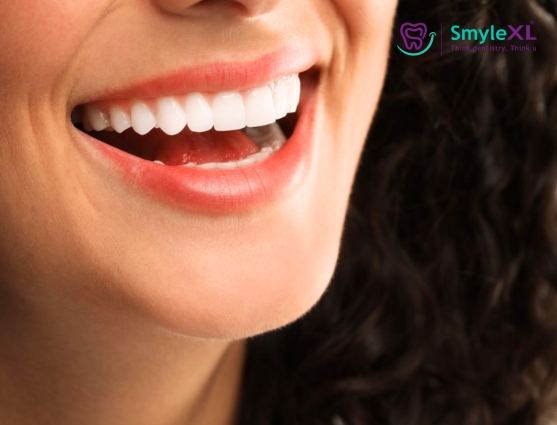 smile makeover treatment