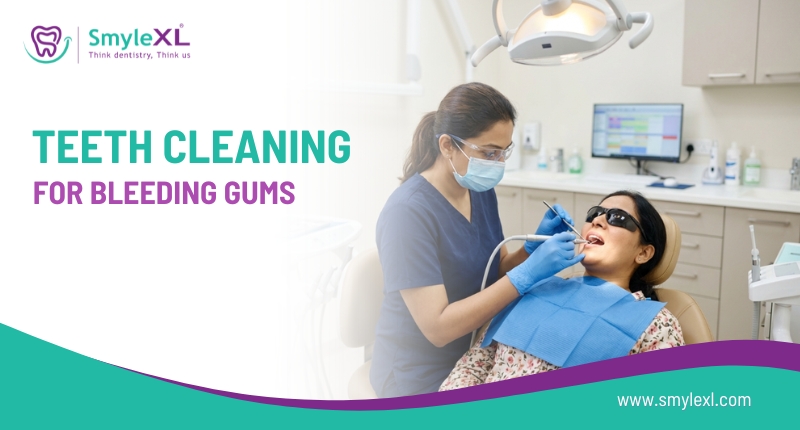 How Does Professional Teeth Cleaning Help Treat Bleeding Gums?