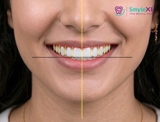 Smile Designing in Salisbury Park