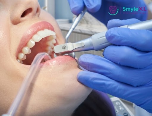 Teeth Cleaning in Salisbury Park