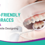 Budget-Friendly Metal Braces in Ashiyana for Better Smile Designing