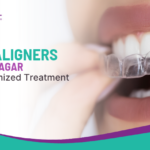 Clear Aligners in Ahilyanagar with Customized Treatment Plans