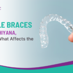 Invisible Braces Cost in Ashiyana, Lucknow – What Affects the Price?