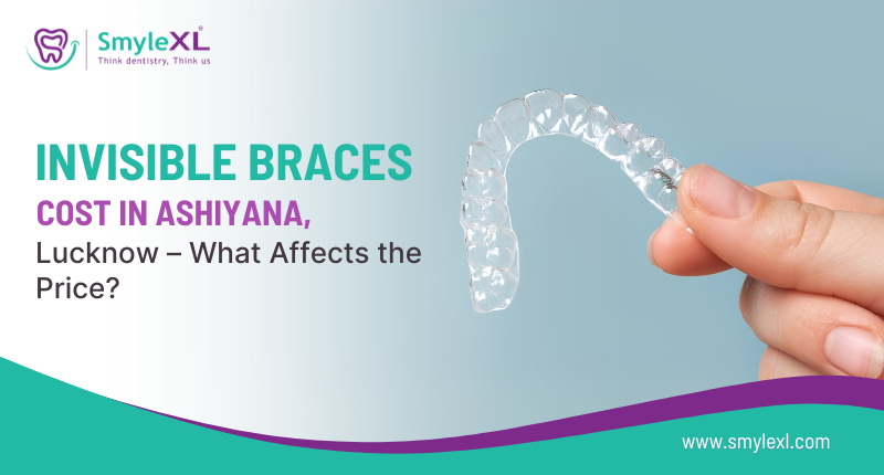 Invisible Braces Cost in Ashiyana, Lucknow – What Affects the Price?