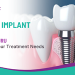 Dental Implant Price in Bengaluru Based on Your Treatment Needs