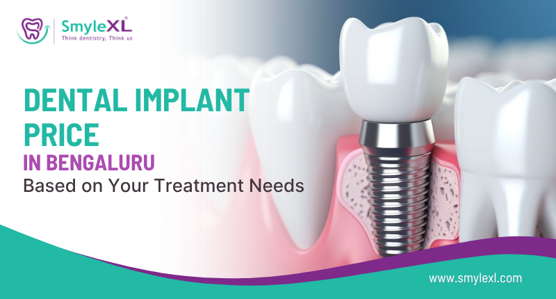 Dental Implant Price in Bengaluru Based on Your Treatment Needs