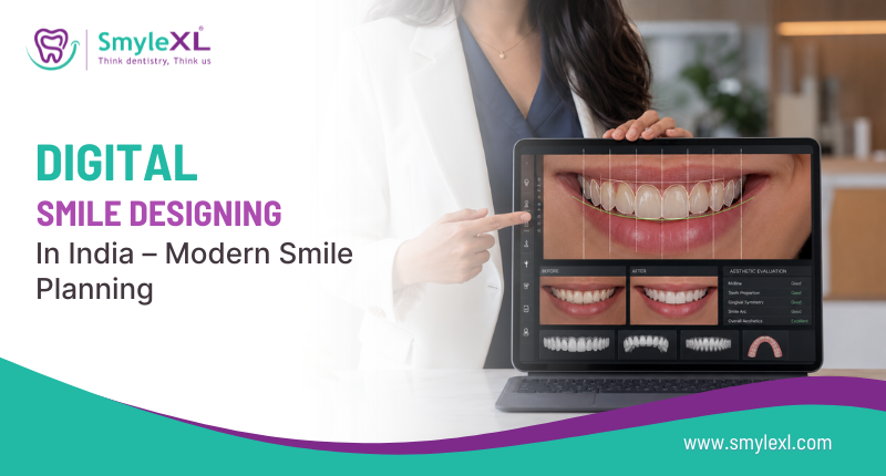 Digital Smile Designing in India – Modern Smile Planning