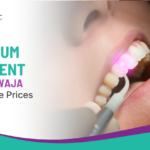 Laser Gum Treatment in Lal Darwaja at Affordable Prices