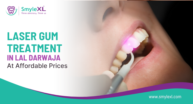 Laser Gum Treatment in Lal Darwaja at Affordable Prices