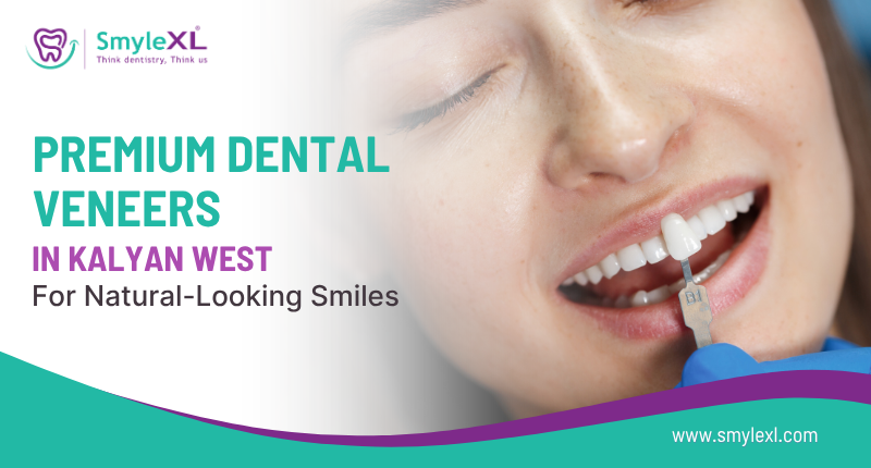 Premium Dental Veneers in Kalyan West for Natural-Looking Smiles