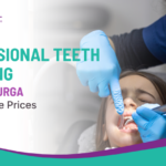 Professional Teeth Cleaning in Chitradurga at Affordable Prices