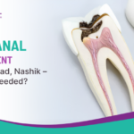 Root Canal Retreatment in Nashik Road, Nashik – When Is It Needed?
