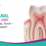 Root Canal Treatment Cost in Lal Darwaja, Surat – What Is Included?
