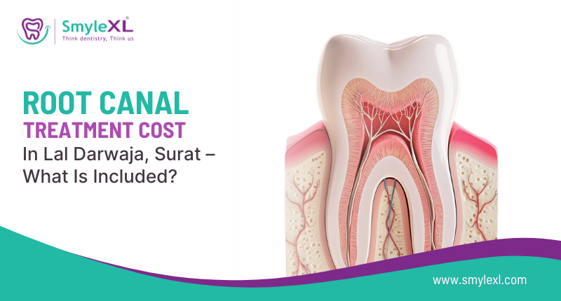 Root Canal Treatment Cost in Lal Darwaja, Surat – What Is Included?