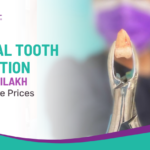 Surgical Tooth Extraction in Pimple Nilakh at Affordable Prices