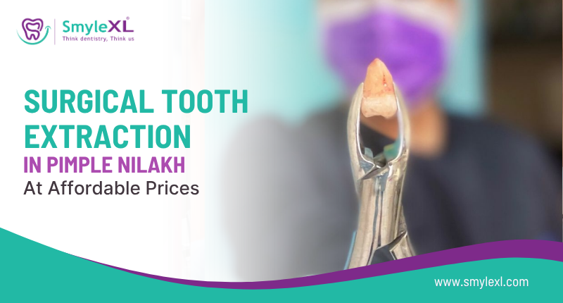 Surgical Tooth Extraction in Pimple Nilakh at Affordable Prices