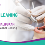 Teeth Cleaning Price in Vanasthalipuram with Professional Scaling