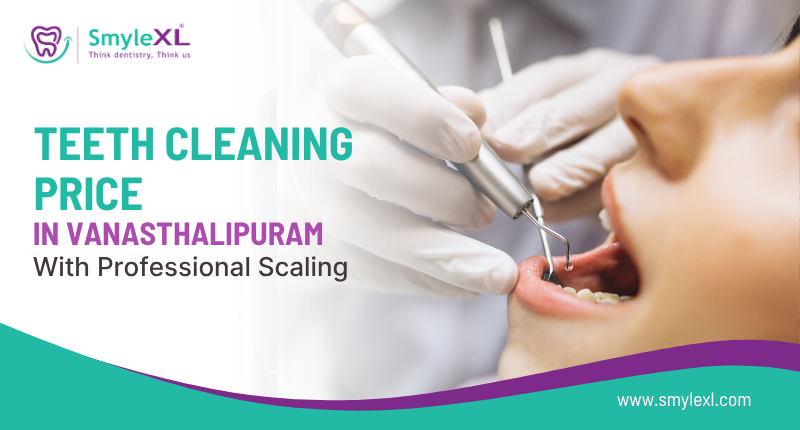 Teeth Cleaning Price in Vanasthalipuram with Professional Scaling