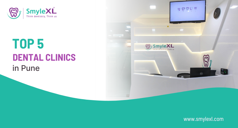 Top 5 Dental Clinics in Pune