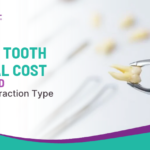 Wisdom Tooth Removal Cost in Sinhagad Road by Extraction Type