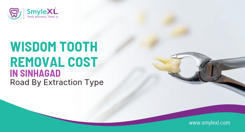 Wisdom Tooth Removal Cost in Sinhagad Road by Extraction Type