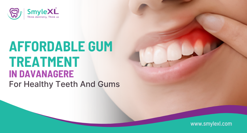 Affordable Gum Treatment in Davanagere for Healthy Teeth and Gums