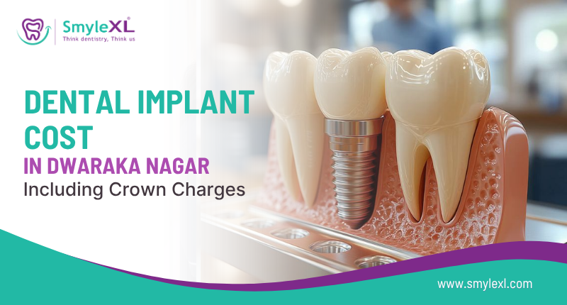 Dental Implant Cost in Dwaraka Nagar Including Crown Charges