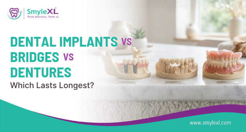 Dental Implants, Bridges, or Dentures: Which Lasts Longer?