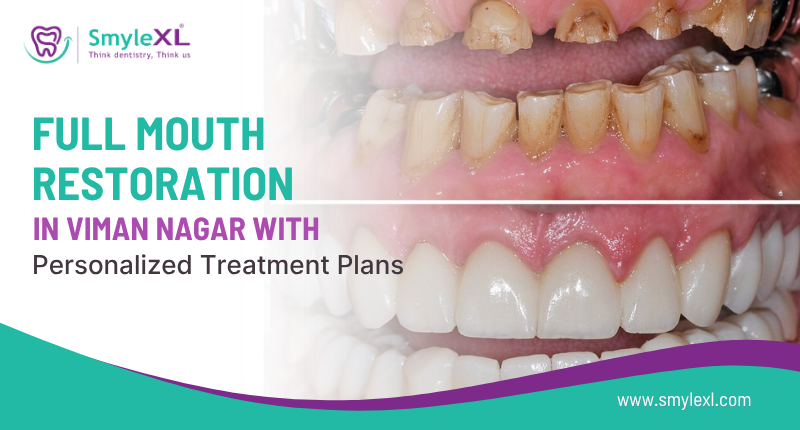 Full Mouth Restoration in Viman Nagar with Personalized Treatment Plans