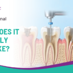 Is a Root Canal Painful – What Does It Actually Feel Like?