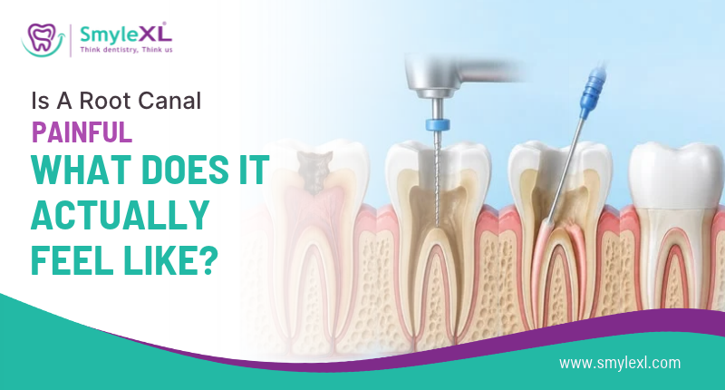 Is a Root Canal Painful – What Does It Actually Feel Like?