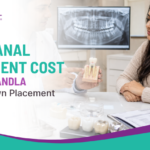 Root Canal Treatment Cost in Nallagandla Before Crown Placement