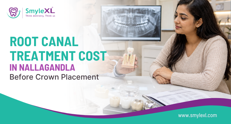 Root Canal Treatment Cost in Nallagandla Before Crown Placement