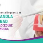 Same-Day Dental Implants in Nallagandla, Hyderabad: How the Procedure Actually Works