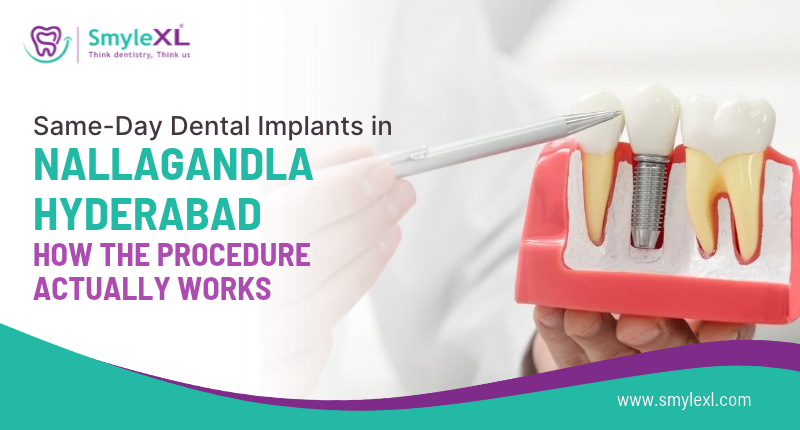 Same-Day Dental Implants in Nallagandla, Hyderabad: How the Procedure Actually Works