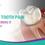 Wisdom Tooth Pain: When to Remove It vs Wait It Out?