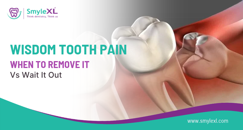 Wisdom Tooth Pain: When to Remove It vs Wait It Out?