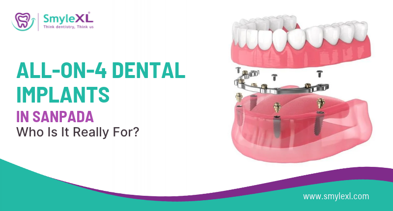 All-on-4 Dental Implants in Sanpada: Who Is It Really For?