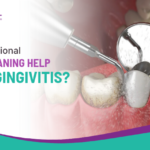 Can Professional Teeth Cleaning Help Treat Gingivitis?