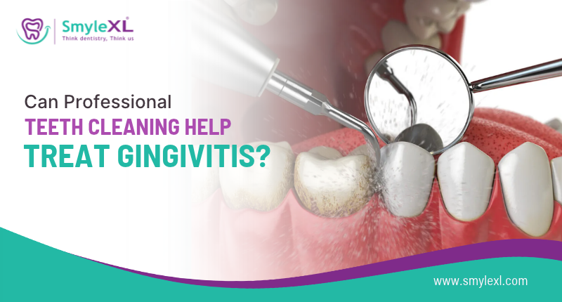 Can Professional Teeth Cleaning Help Treat Gingivitis?