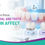 Dental Crown Price: How Material and Tooth Location Affect Pricing