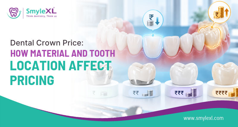 Dental Crown Price: How Material and Tooth Location Affect Pricing