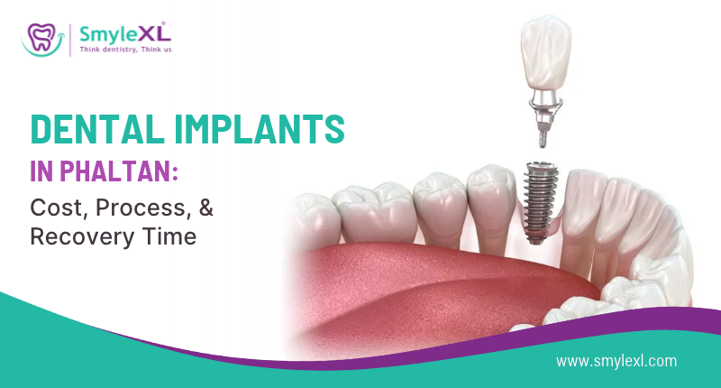 Dental Implants in Phaltan: Cost, Process, and Recovery Time