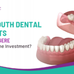 Full Mouth Dental Implants in Davanagere: Is It Worth the Investment?