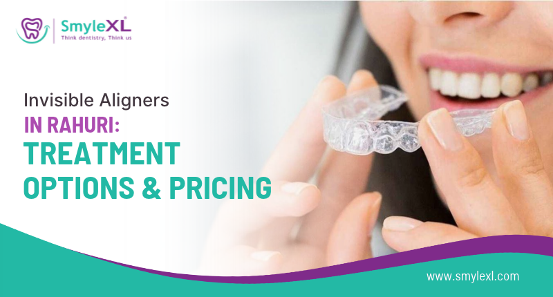 Invisible Aligners in Rahuri: Treatment Options and Pricing