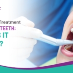 Root Canal Treatment for Front Teeth: When Is It Needed?