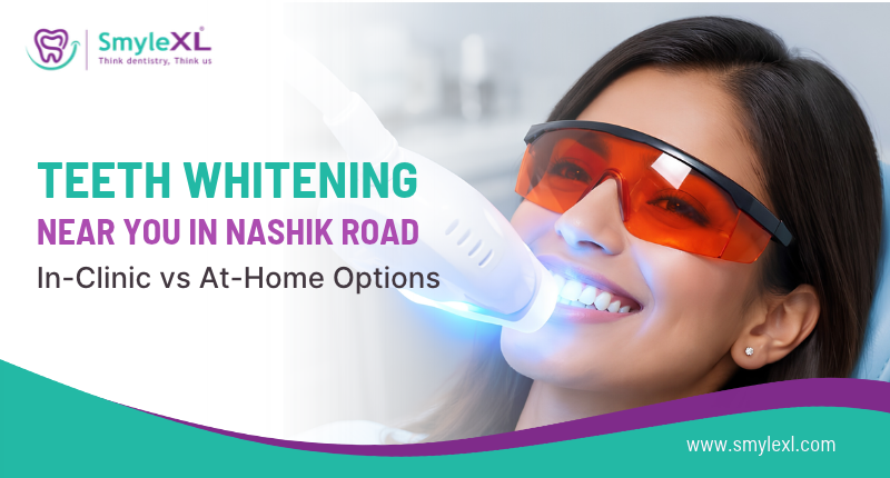 Teeth Whitening Near You in Nashik Road: In-Clinic vs At-Home Options
