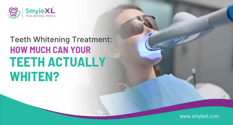 Teeth Whitening Benefits: Confidence, Oral Health, and Appearance Boost