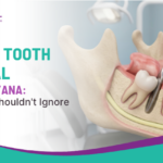 Wisdom Tooth Removal Near Ashiyana: Signs You Shouldn’t Ignore